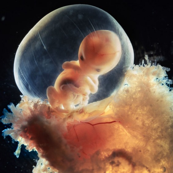 preg-14_1494400i